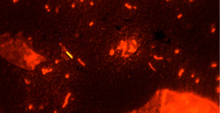 MSD Animal Health alerta para toxocara spp nos jardins e parques infantis
