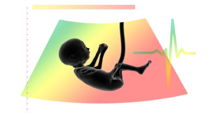 Autismo: sangue do cordão umbilical melhora os níveis de comunicação, socialização e inteligência não verbal