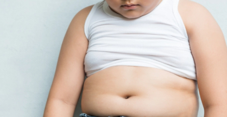 Obesidade infantil poderá atingir um terço das crianças até 2050