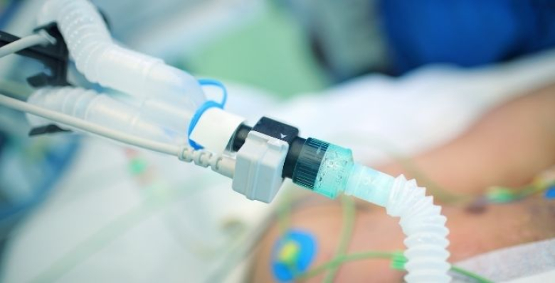 Ferramenta inovadora reduz tempo em ventilador para crianças com ARDS