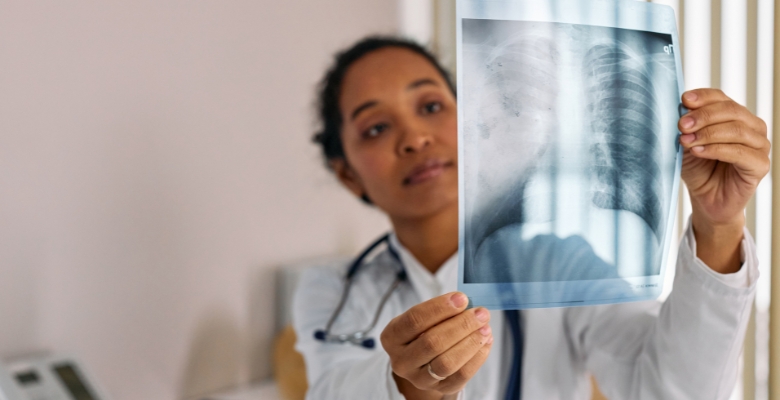 Estudo alerta para progressão silenciosa da fibrose cística na infância